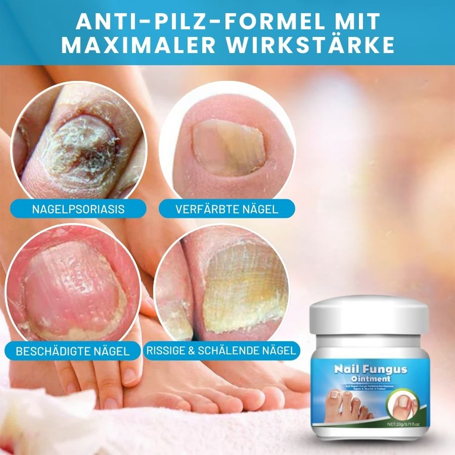KlarNagel™  | Schnelle Antipilz-Salbe