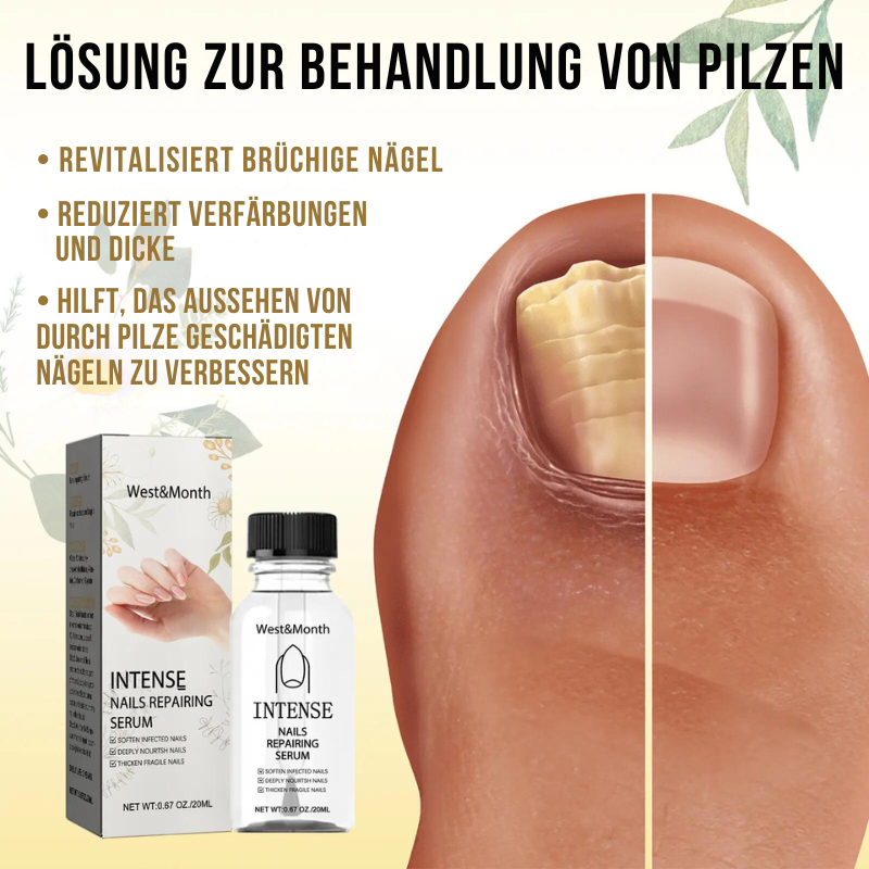 StarkNagel™ | Stärken Sie Ihre brüchigen Nägel in nur 1 Woche!