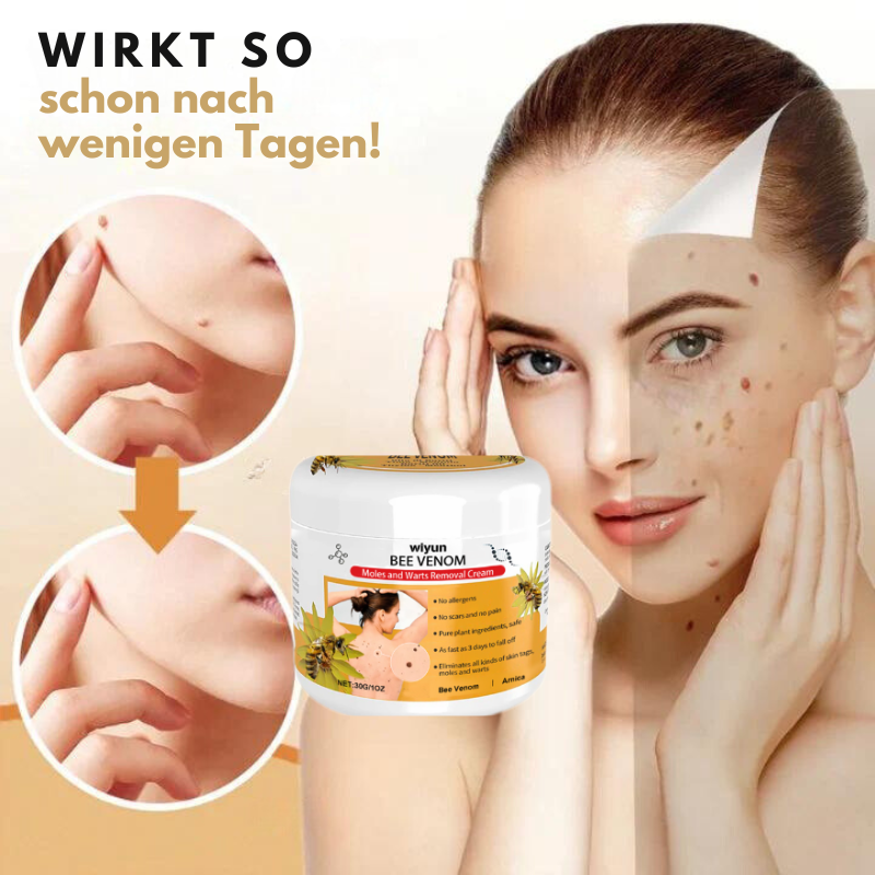 HautKlar™ | Beseitigen Sie lästige Hautwarzen in nur 1-3 Wochen!