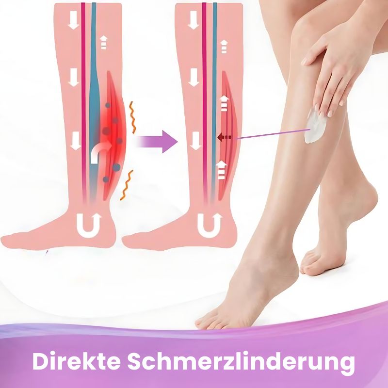 VaricoseKur™ | Krampfaderentfernung Creme