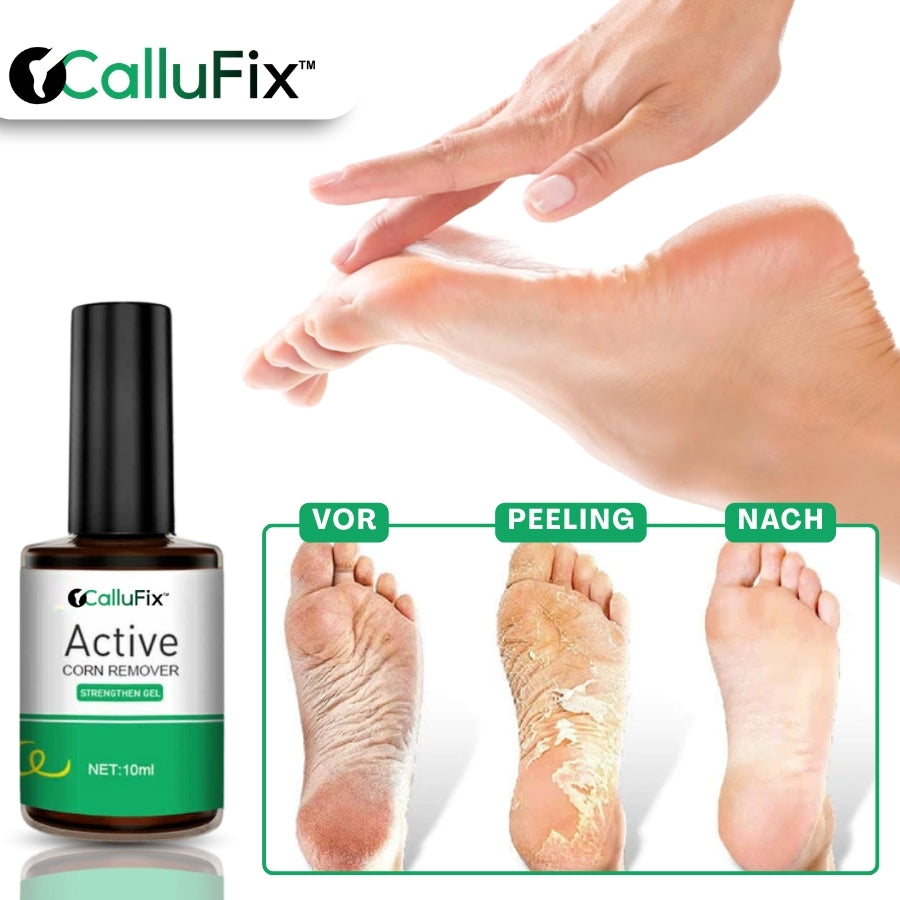 CalluFix™ | Aktives Hornhautentferner-Gel