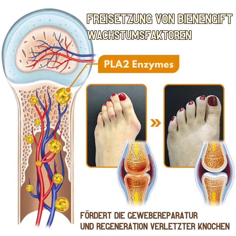 HalluxHeilung™ | Machen Schluss den Schmerzen des Ballenzehens in nur einem Monat!