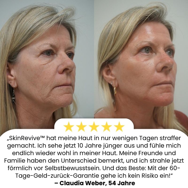 SkinRevive™ | Strafft die Haut in 72 Stunden