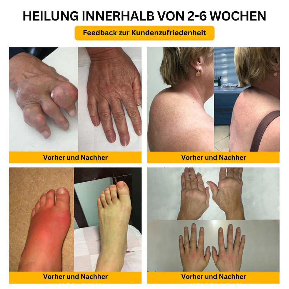 BienenGift™ | Fortgeschrittene Gelenk- und Knochentherapie-Creme