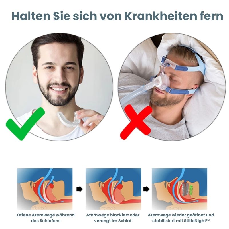 StilleNight™ | Apnea Oral Appliances
