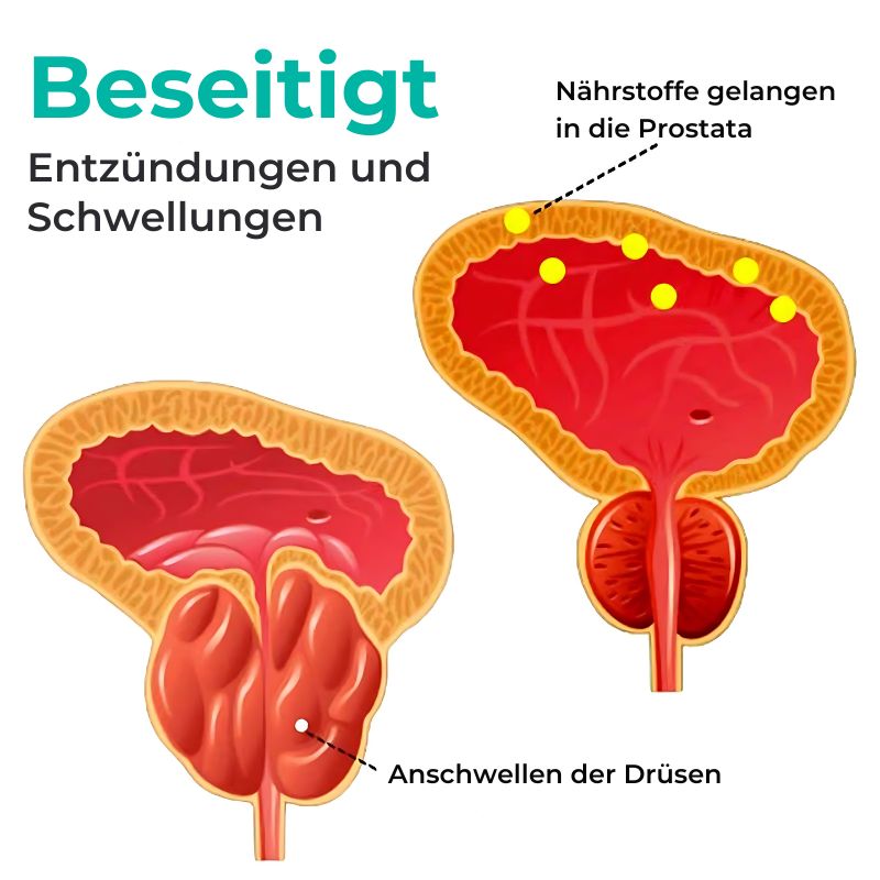 ProstaHeil™ | Prostata-Creme