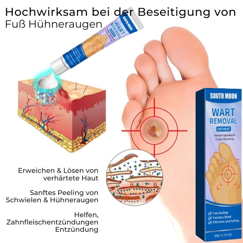FußCornLösung™ | Kräuter-Fußschwielenentfernungssalbe