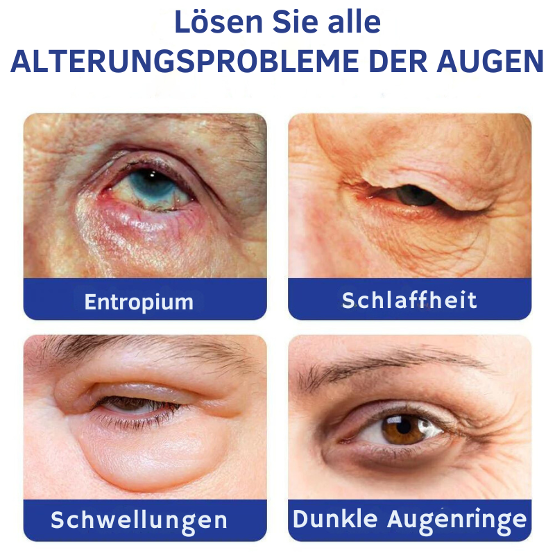 KlarVision™ | Gewinnen Sie strahlende, jugendliche Augen in nur 1 Woche zurück!