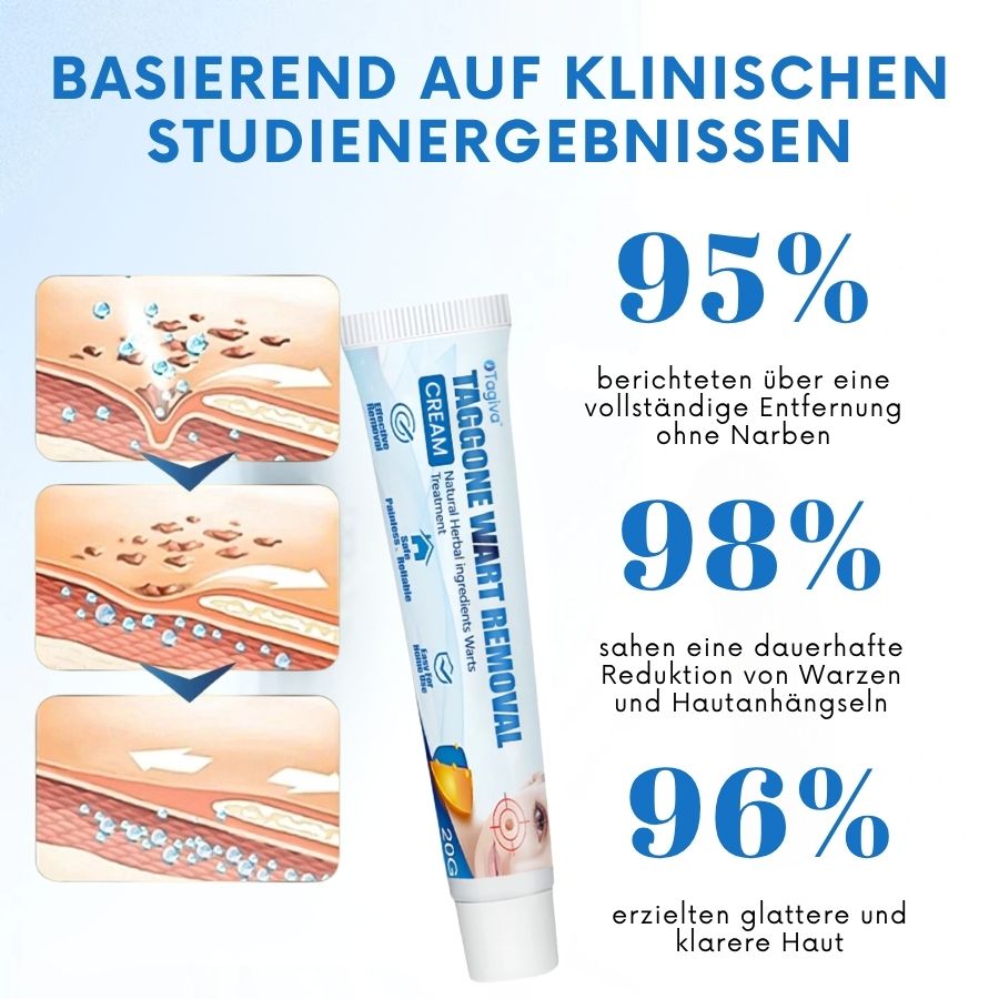 Tagiva™ | TagGone Warzenentfernungscreme