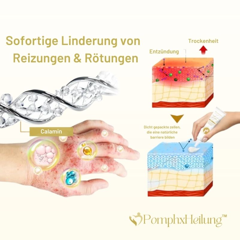 PomphxHeilung™ | Pompholyx-Linderungscreme