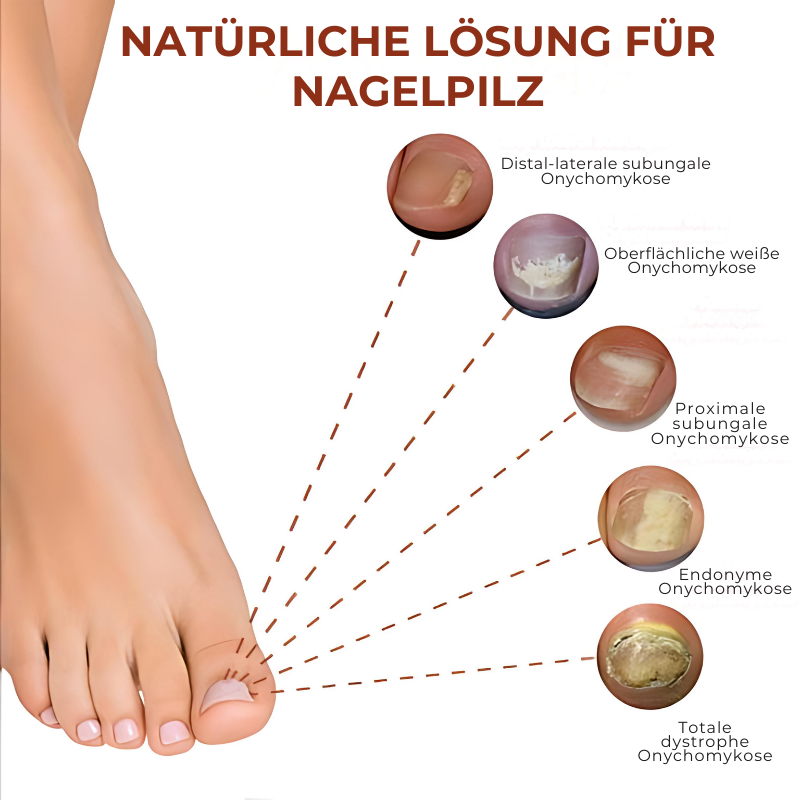 NagelSerum™ | 7 Tage Maximum Strength Nail Repair Serum