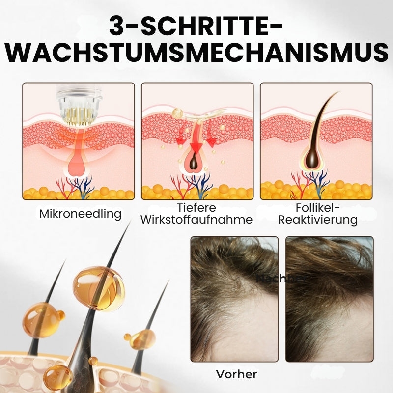 RootLuxe™ | Mikronadel-Haarwuchs-Set