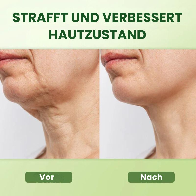 KollagenBoost™ | Kollagen Straffende Körpercreme