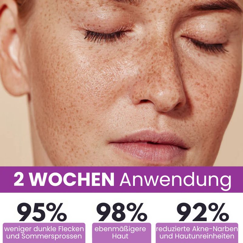 MelanoFix™ | Anti-Hyperpigmentierungsserum