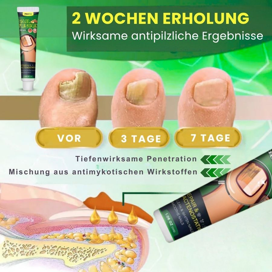 MycoClear™ | Nagelpilzbehandlungscreme