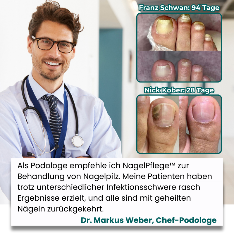 NagelPflege™ Stift | Nagelstift zur Bekämpfung von Nagelpilz