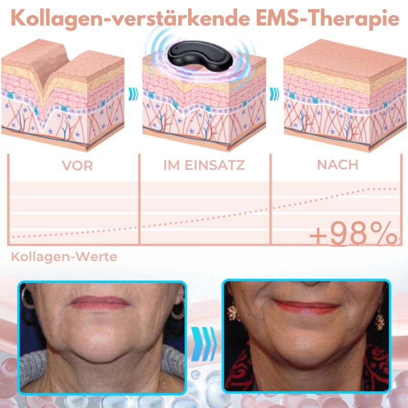 EMSGesichtsTon™ | EMS-Sculpting-Schönheitsgerät