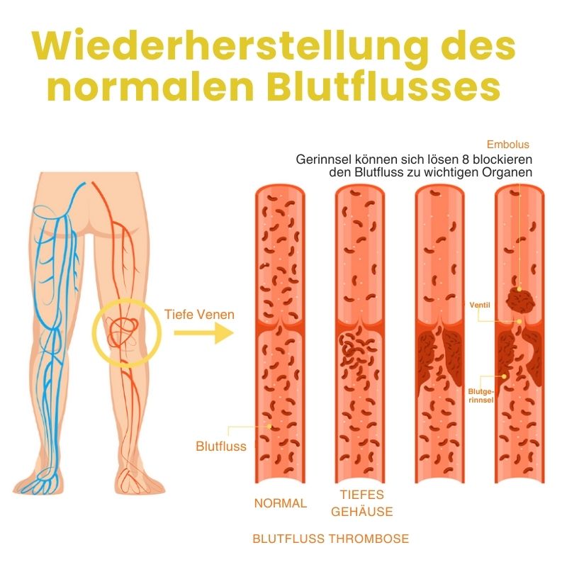 ArthroVeinSalbe™ | Creme zur Behandlung von Arthritis und Krampfadern