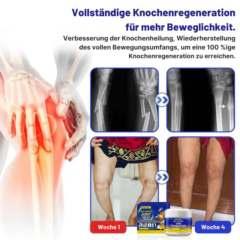 GelenkPro™ | Linderung von Gelenksteifheit und Schwellungen in nur wenigen Wochen!