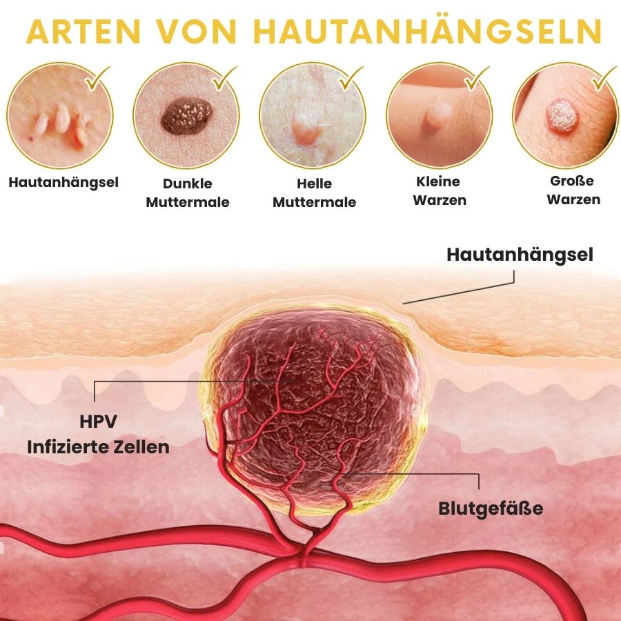 BeeKlar™ | Bienengift Hautanhängsel-Entferner Pflaster