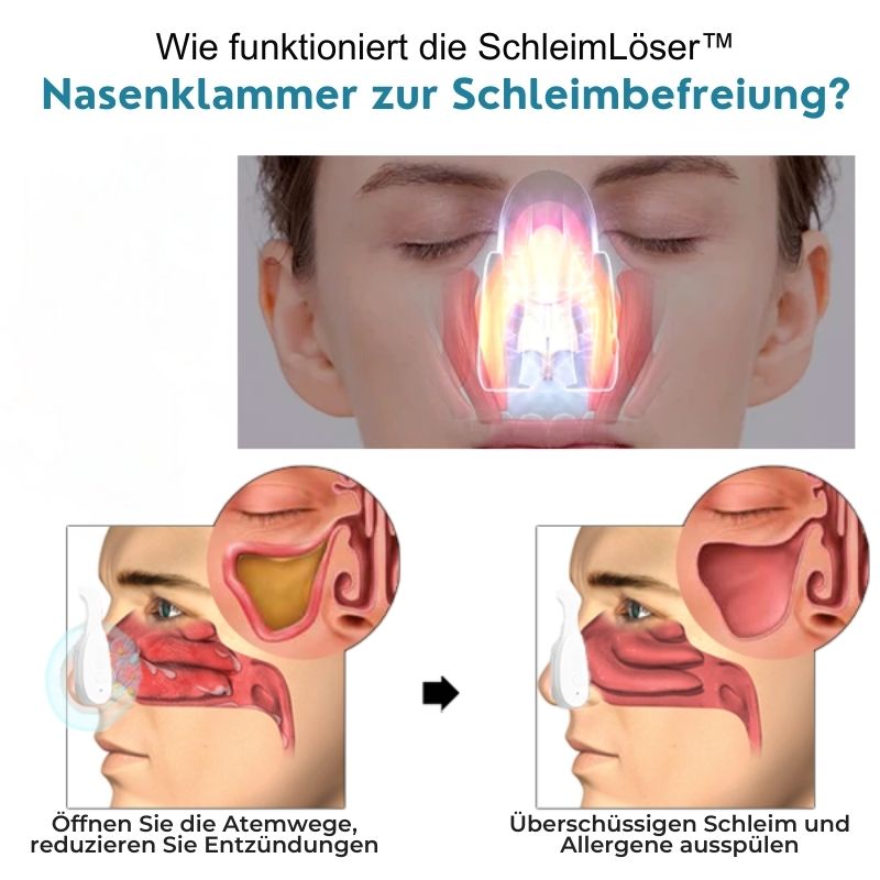 SchleimLöser™ | Nasenschleim-Reinigungsgerät