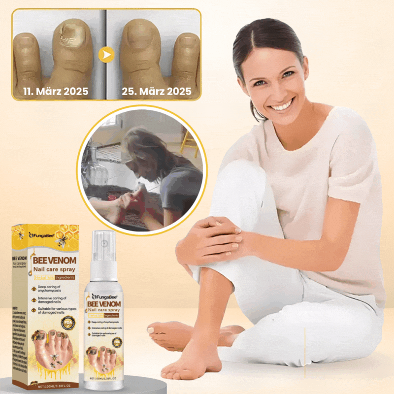 FungaBee® | Nagelpflegespray mit Bienengift
