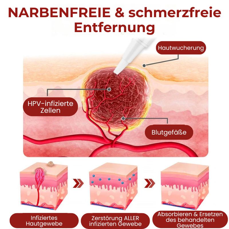 DermaFix™ | Serum-Stift zur Entfernung von Hautwucherungen und Muttermalen