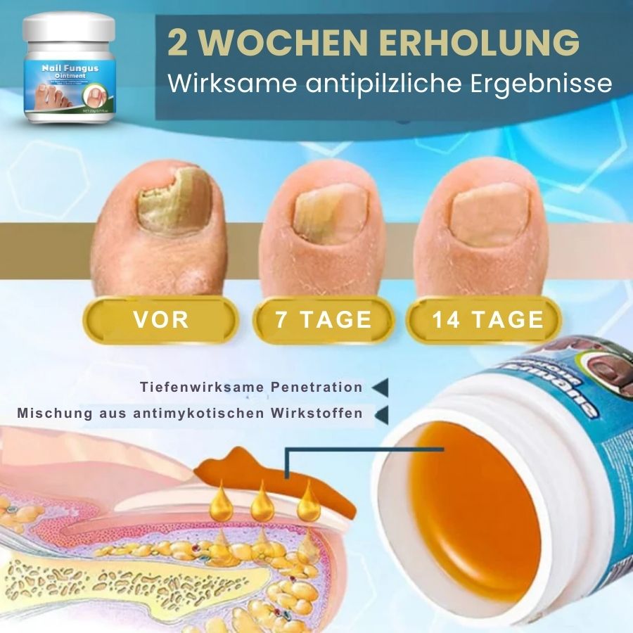 KlarNagel™  | Schnelle Antipilz-Salbe
