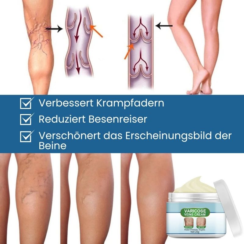 VenoKlar™ | Krampfadern- & Besenreiser-Creme