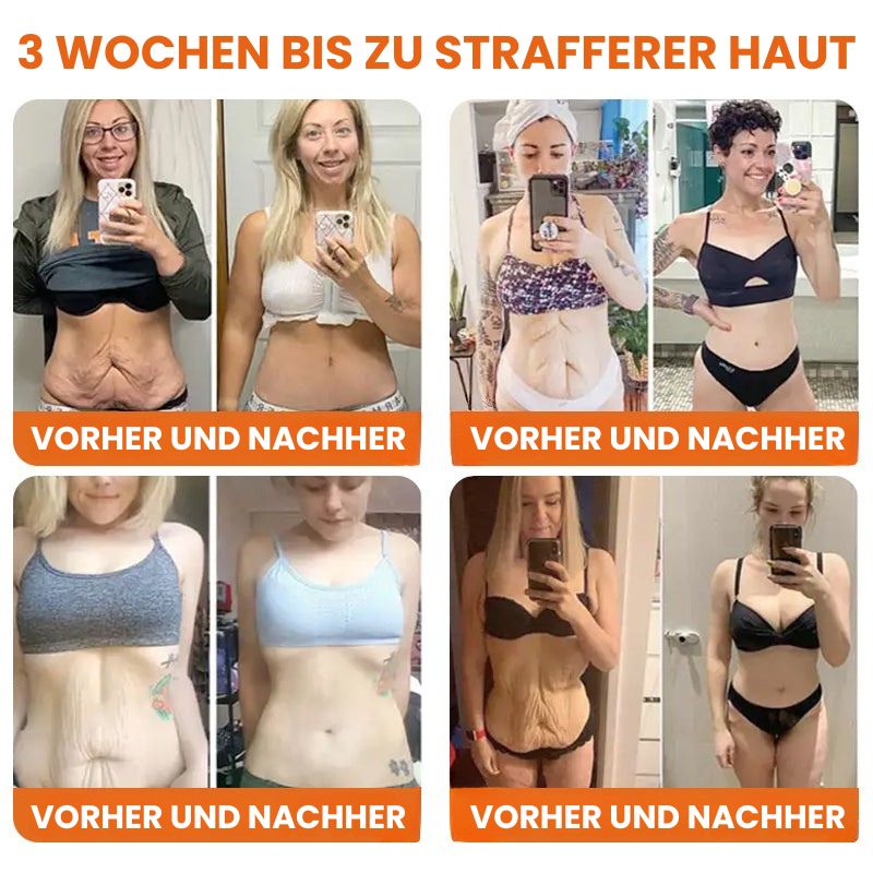 BienenStraff™ | Straffender Stick