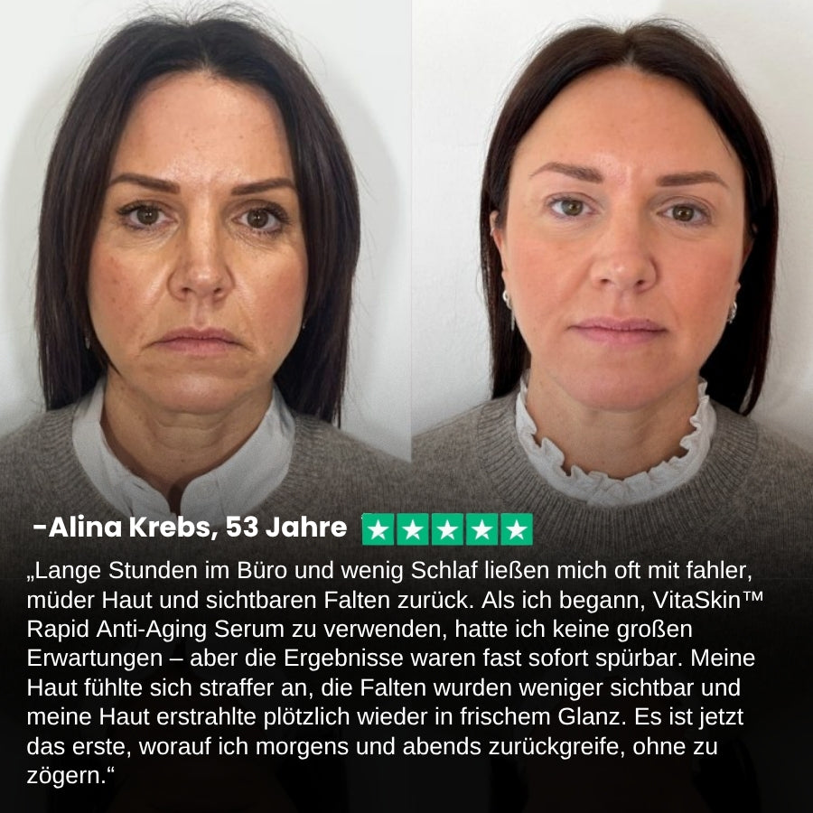 VitaSkin™ | Super C Anti‑Aging‑Serum