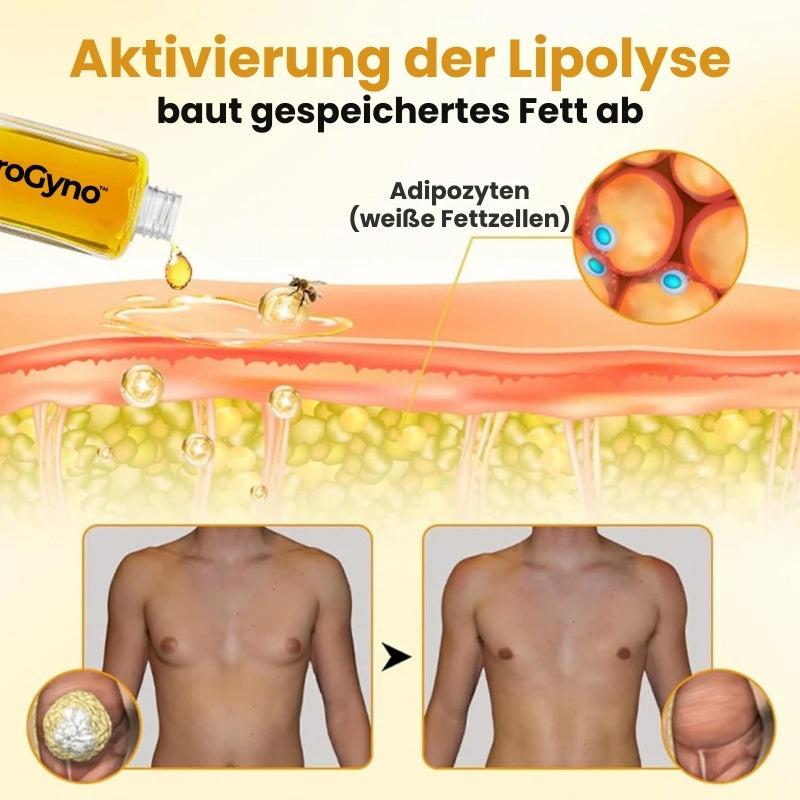 ZeroGyno™ | Bienengift-Serum gegen Gynäkomastie bei Männern