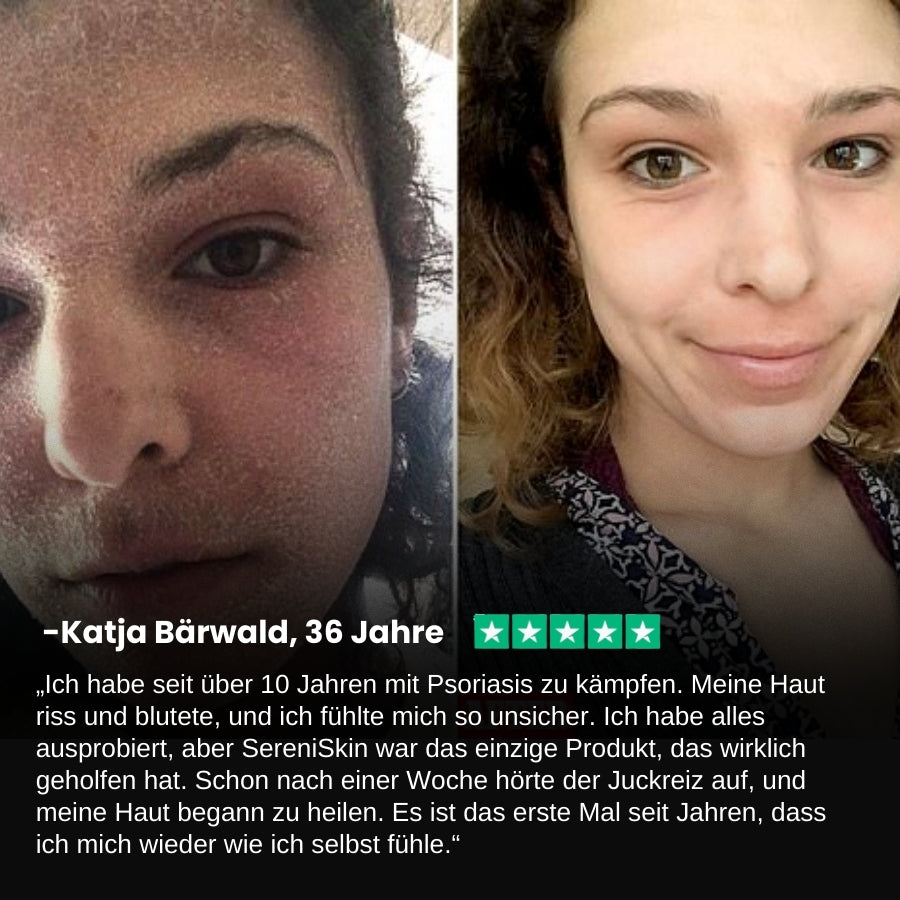 SereniSkin™ | Magnesium Kräuter Beruhigungs-Spray