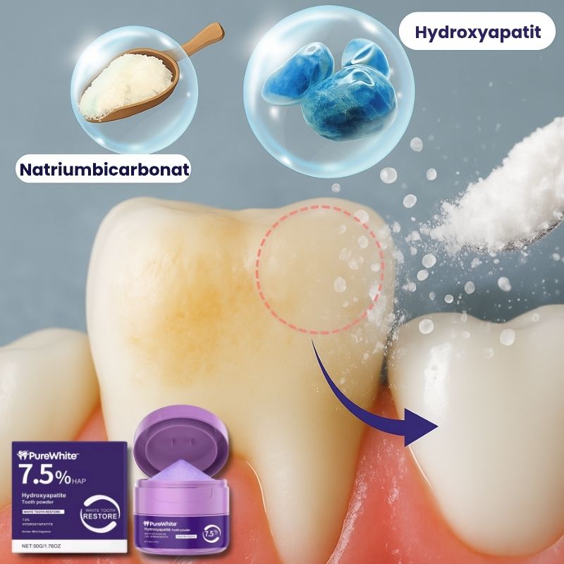 PureWhite™ | Zahnaufhellungs-Kit