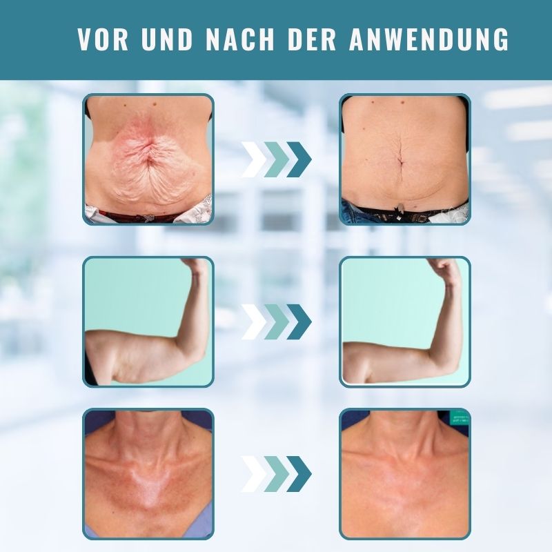 GlowStraff™ | Hautstraffendes Körperöl