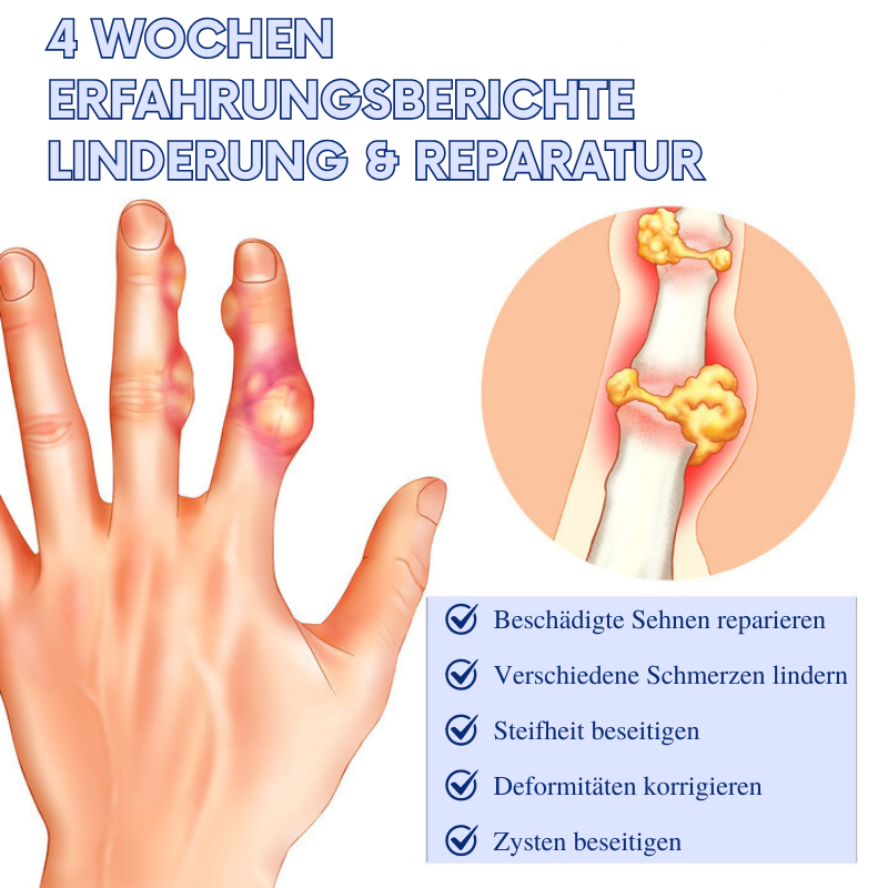 ArthroFrei™ | Beenden Ihr Leiden unter Gelenkschmerzen in nur 7 Tagen!