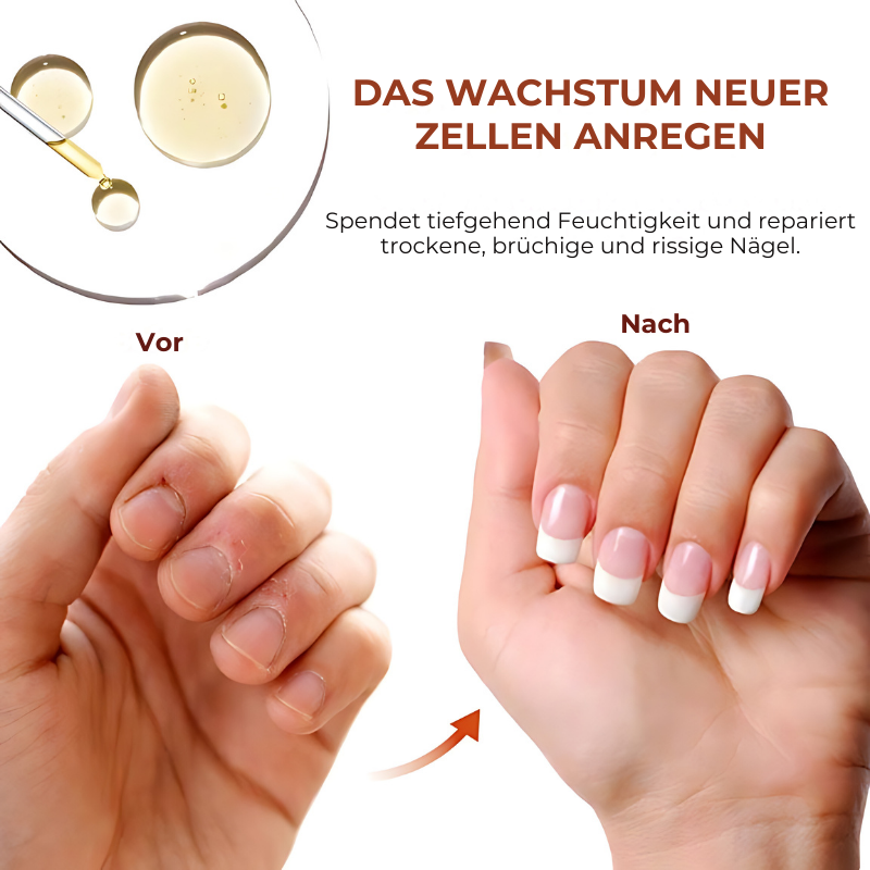 NagelSerum™ | 7 Tage Maximum Strength Nail Repair Serum