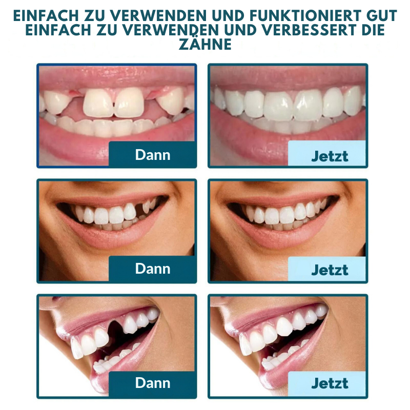 ZahnPflege™ | Lächeln Sie ohne Sorgen in nur 1 Sekunde!