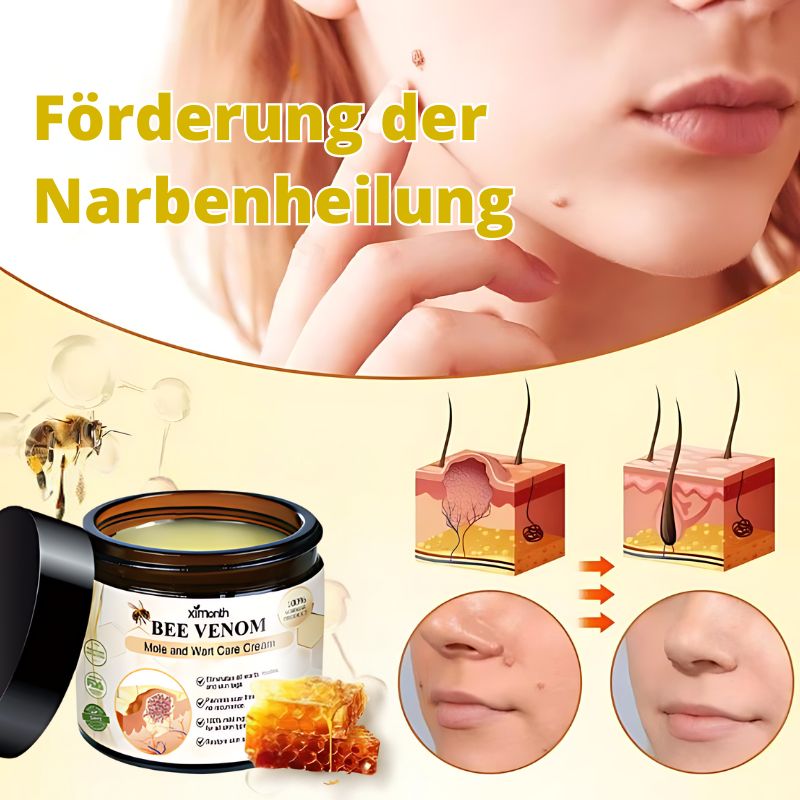 WarzenFix™ | Bienenstich-Reparatur- und Feuchtigkeitscreme