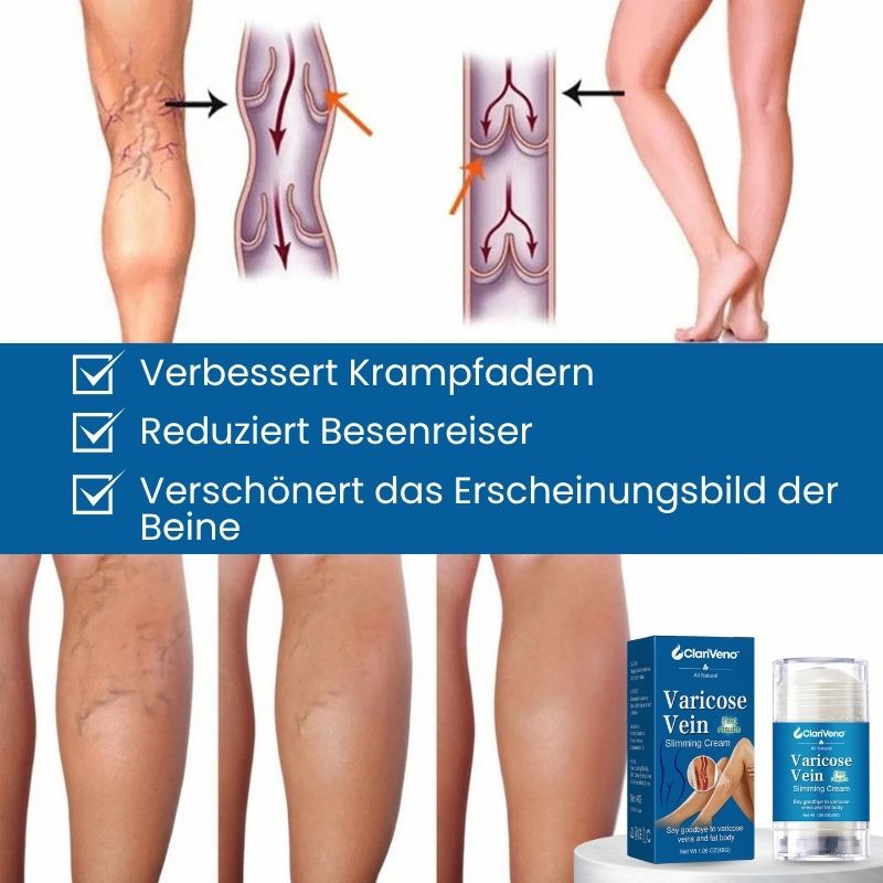 ClariVeno™ | Krampfader-Stick-Creme