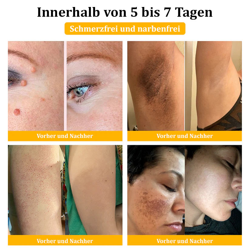 Dermatest-Zertifizierung | ApisGlow™ Bienengift-Hautcreme Bienengift-Hautcreme (BfArM empfohlen) (LETZTER TAG 70% RABATT)