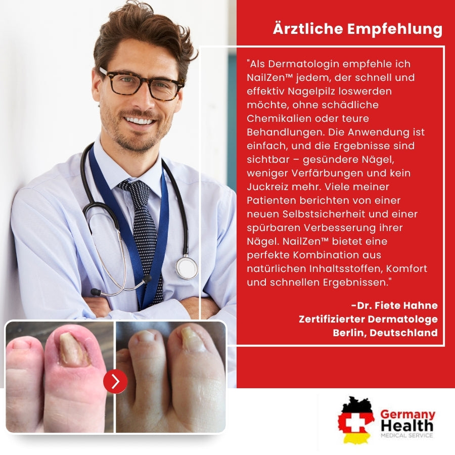 NailZen™ | Hagebuttenöl Nagelbehandlung