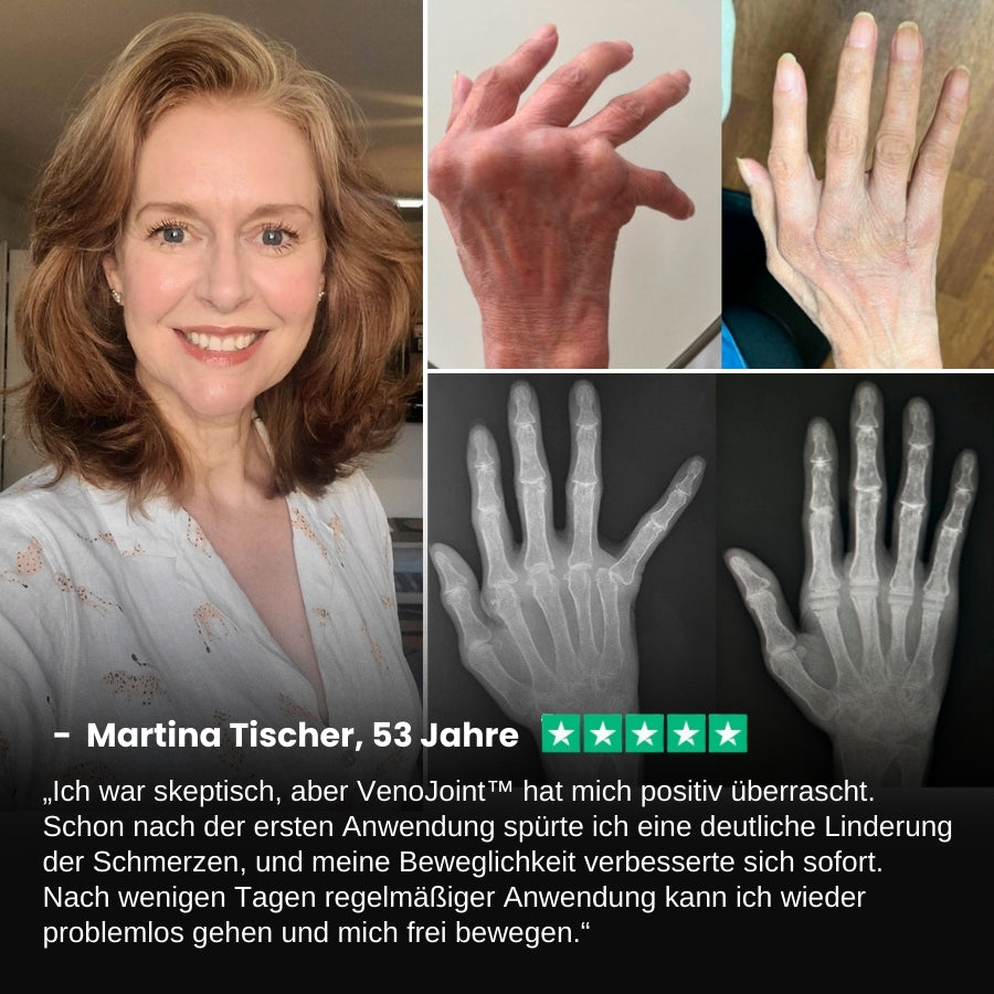 VenoJoint™ | Bienenstichgift-Gelenkregenerierungscreme