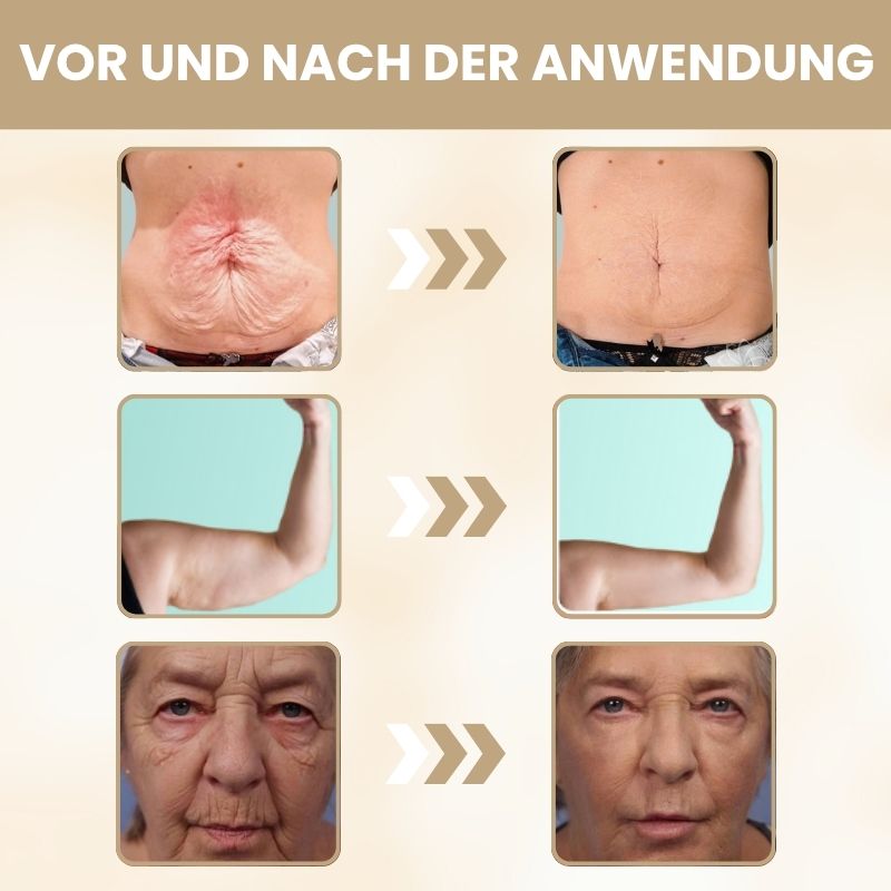 VitaLift™ | Rinderfett für Hautstraffung