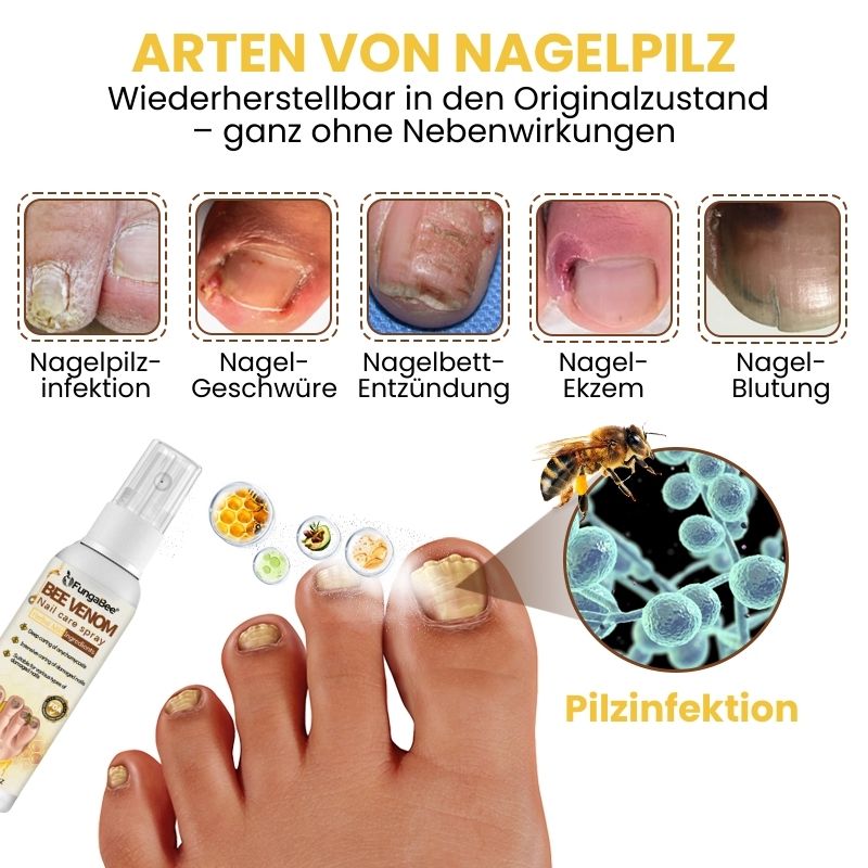 FungaBee® | Nagelpflegespray mit Bienengift