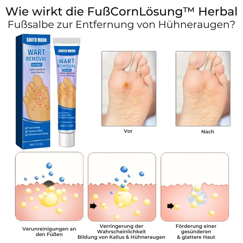 FußCornLösung™ | Kräuter-Fußschwielenentfernungssalbe