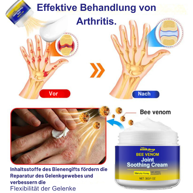 GelenkPro™ | Linderung von Gelenksteifheit und Schwellungen in nur wenigen Wochen!