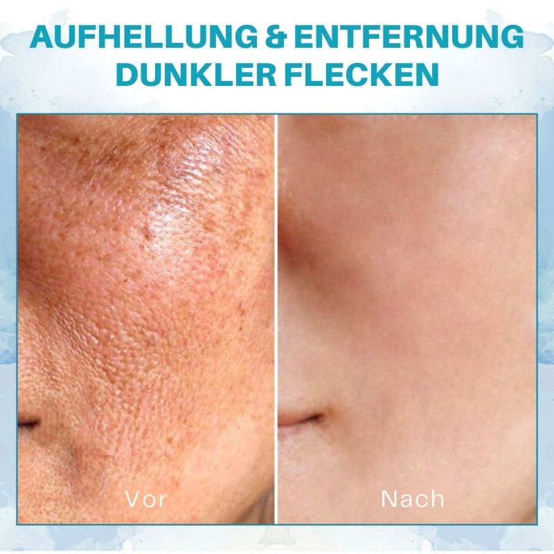 HautLift™ | Hautstraffendes Jugendbutter