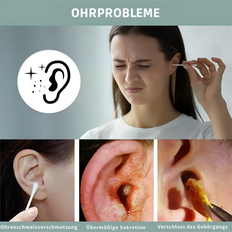 OhrWohl™ | Schnelle Beseitigung von Ohrenverstopfungen in nur 1 Anwendung!
