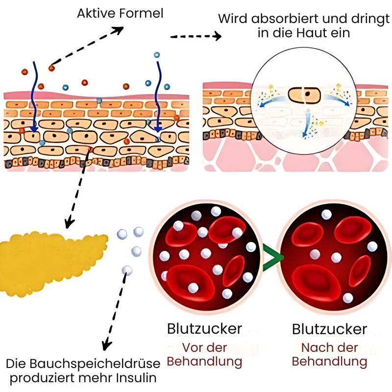 GlucoEase™ | Massageöl für Diabetiker